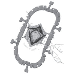 Jorgensen Labs Lone Star Retractor